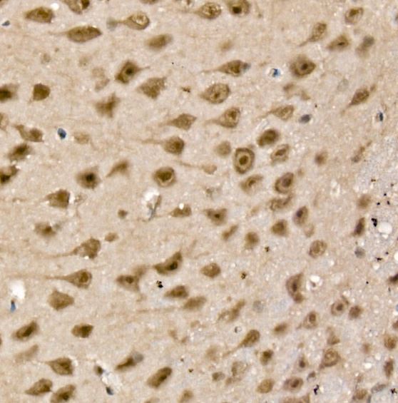 UCH-L5/UCH37 Antibody