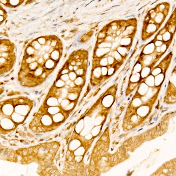 RPS10 Antibody - BSA Free