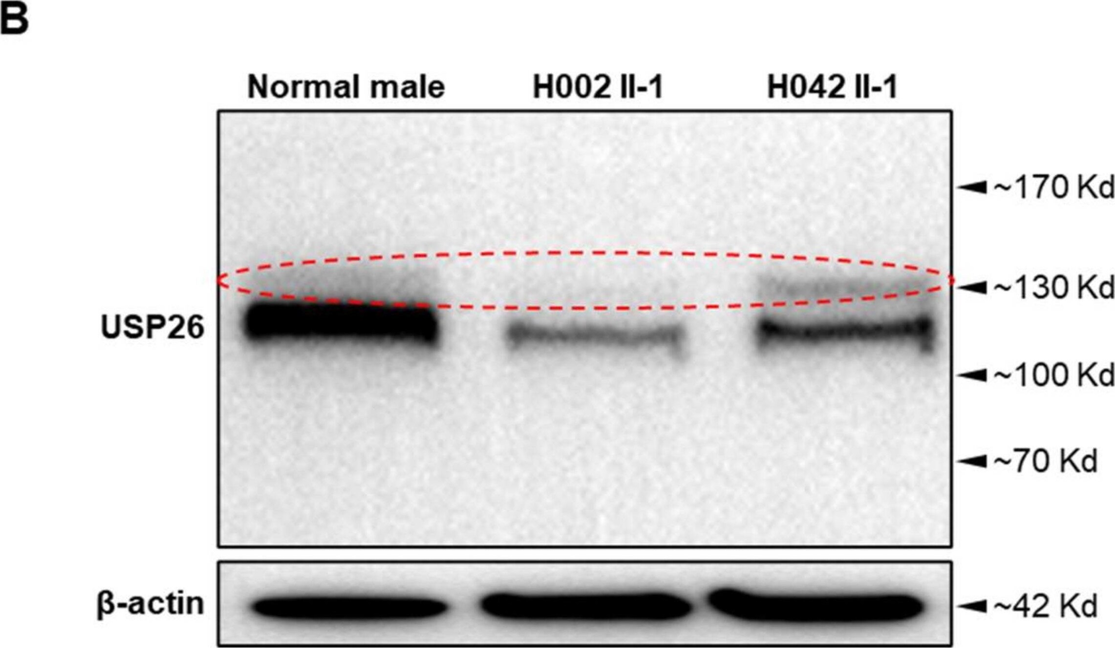 USP26 Antibody - BSA Free