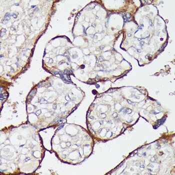 SLC7A2 Antibody - Azide and BSA Free