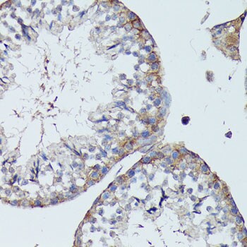 SLC7A2 Antibody - Azide and BSA Free