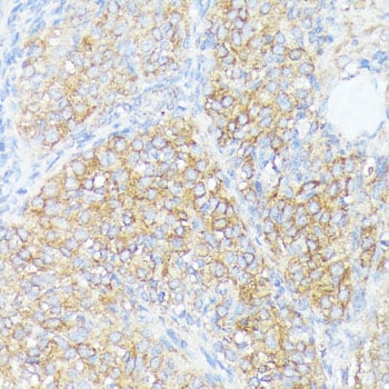 SLC7A2 Antibody - Azide and BSA Free