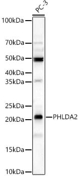 TSSC3 Antibody - BSA Free