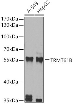 TRMT61B Antibody - BSA Free