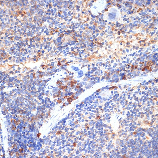 RB1CC1 Antibody - Azide and BSA Free
