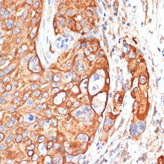 RB1CC1 Antibody - Azide and BSA Free