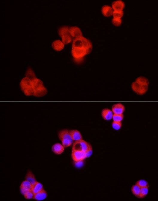 SQLE Antibody