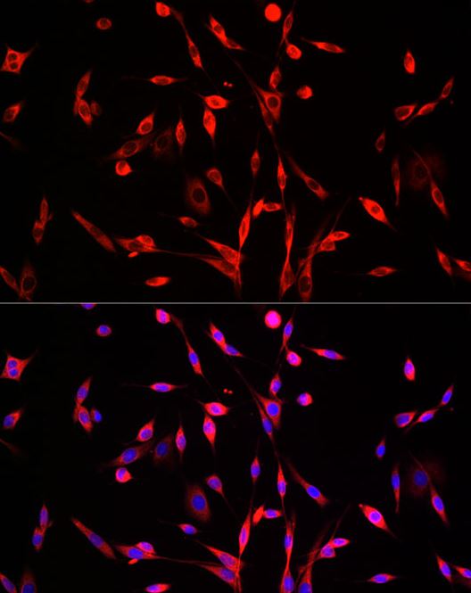 SQLE Antibody