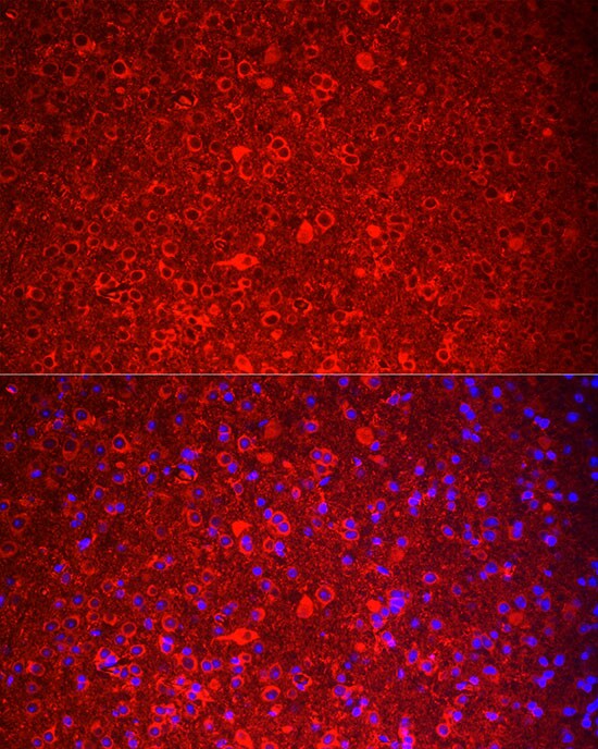 Neurokinin B Antibody - BSA Free