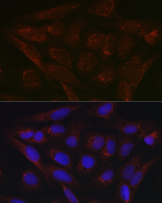 PDK4 Antibody - Azide and BSA Free