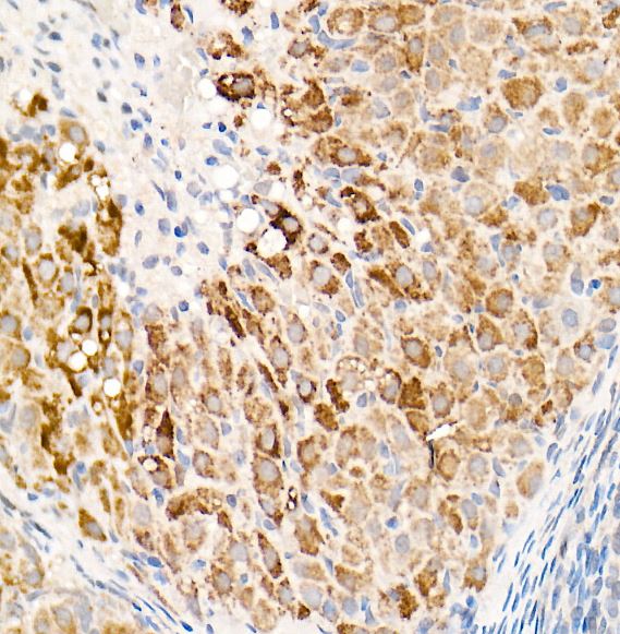 OGDH Antibody