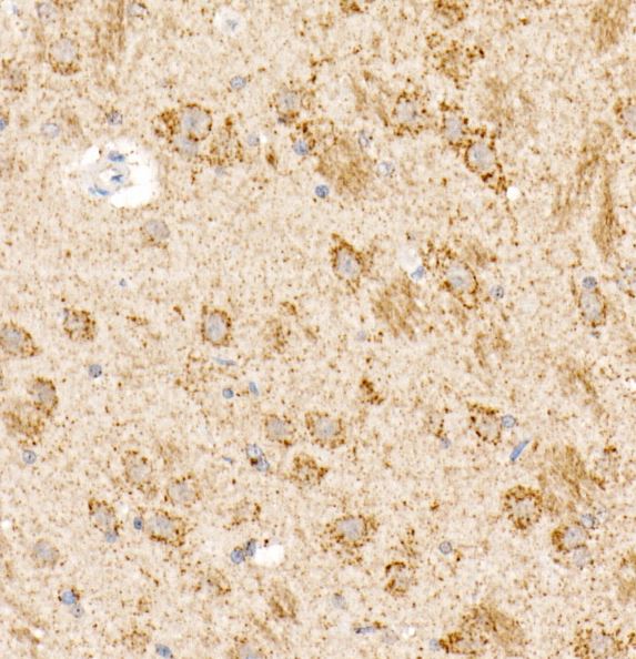 OGDH Antibody