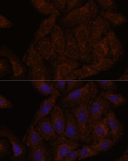 Septin-8 Antibody - Azide and BSA Free