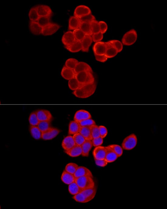 PABP Antibody - Azide and BSA Free
