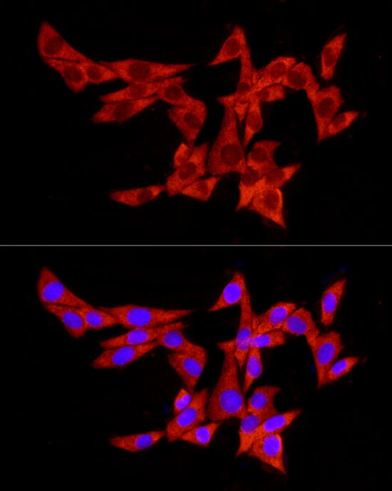 PABP Antibody - Azide and BSA Free