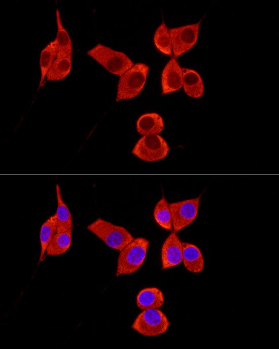 PABP Antibody - Azide and BSA Free