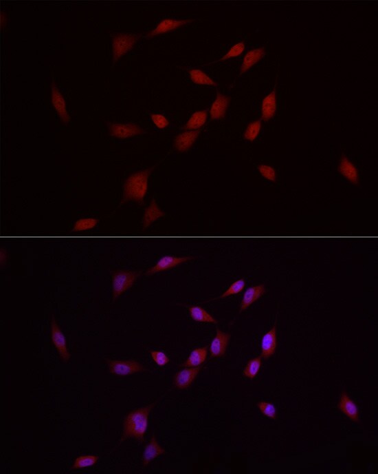 Smad7 Antibody - Azide and BSA Free