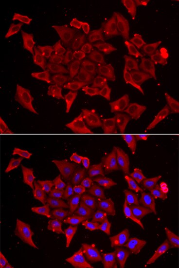 TIMM17A Antibody - BSA Free