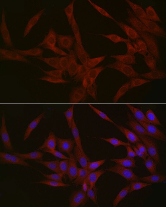 Nephronophthisis Antibody - Azide and BSA Free