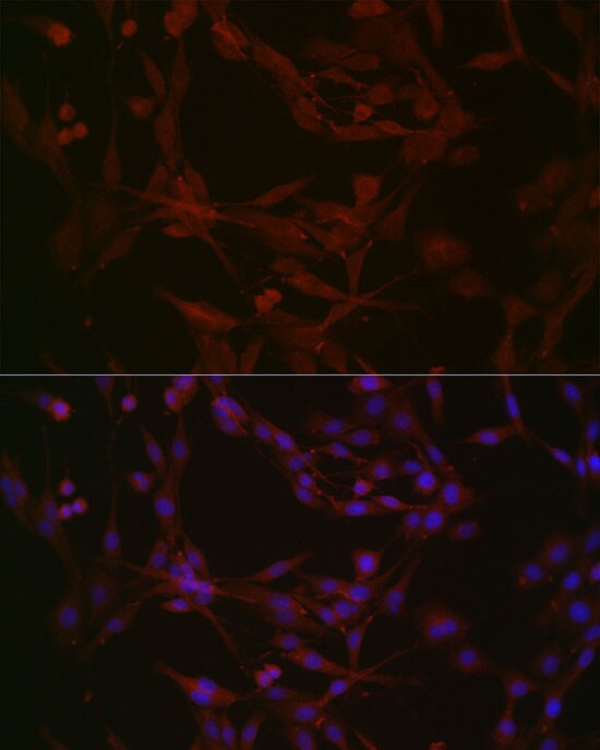 Nephronophthisis Antibody - Azide and BSA Free