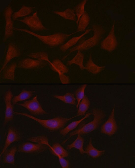 Nephronophthisis Antibody - Azide and BSA Free