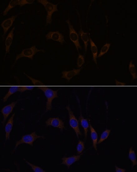 RGS4 Antibody - Azide and BSA Free
