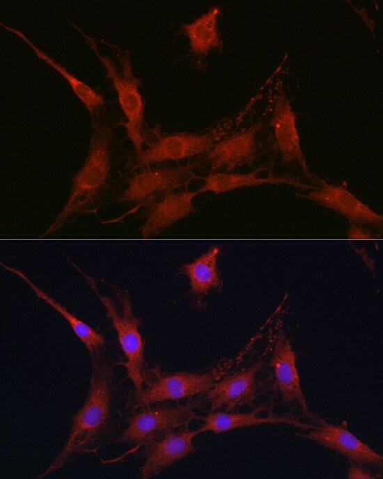 SLC4A4 Antibody - Azide and BSA Free