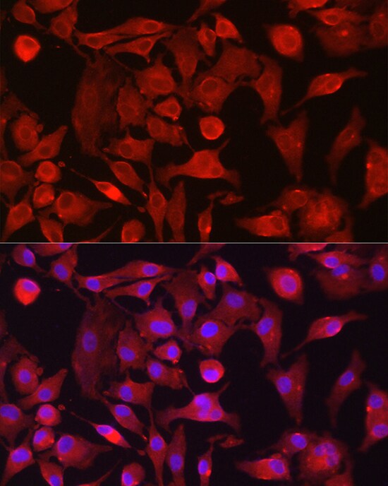Rasgrp1 Antibody - BSA Free