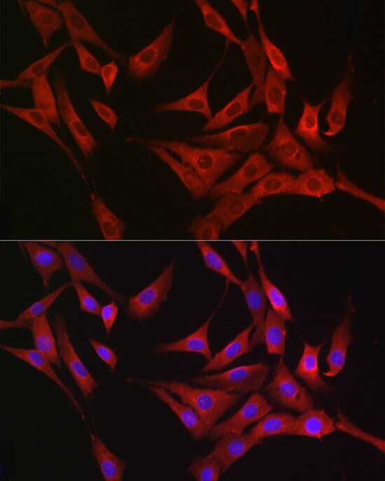 Rasgrp1 Antibody - BSA Free
