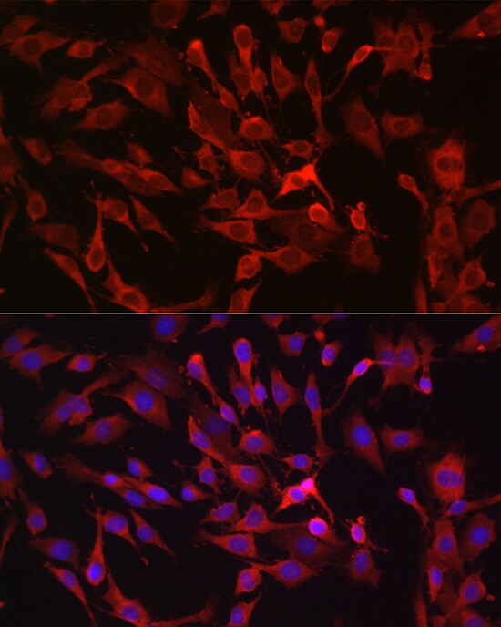 Rasgrp1 Antibody - BSA Free