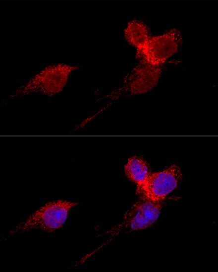 RPL36 Antibody - BSA Free