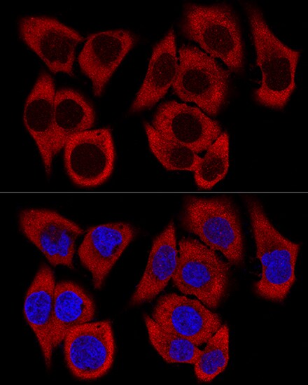 RPL36 Antibody - BSA Free