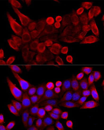 VDAC3 Antibody - Azide and BSA Free