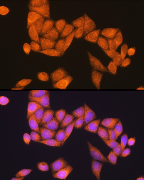 RAP1B Antibody - Azide and BSA Free