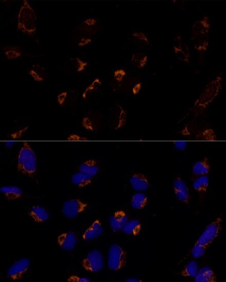 MTCH2 Antibody - Azide and BSA Free