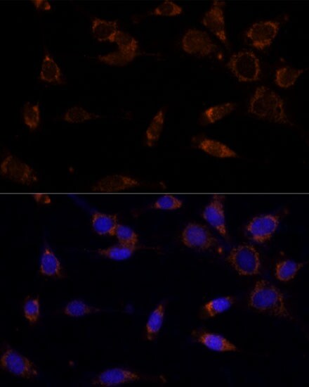 MTCH2 Antibody - Azide and BSA Free