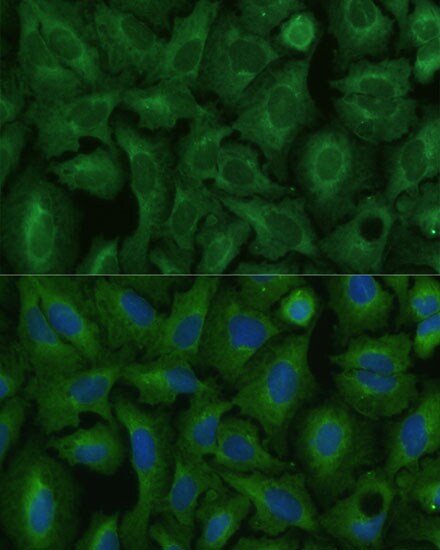 TIMM8B Antibody - Azide and BSA Free
