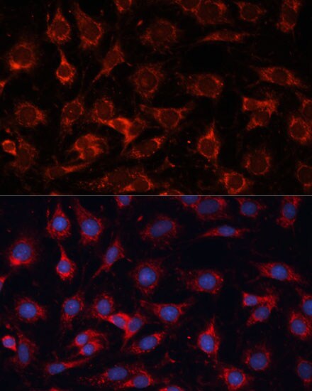 PDHA2 Antibody - BSA Free