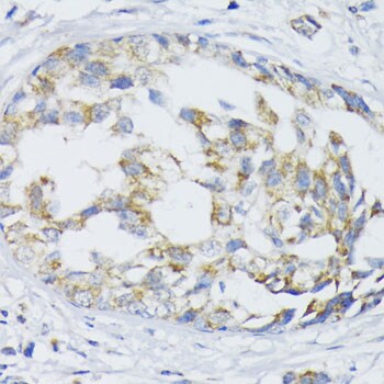 SLC30A1 Antibody - BSA Free