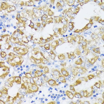 SLC30A1 Antibody - BSA Free