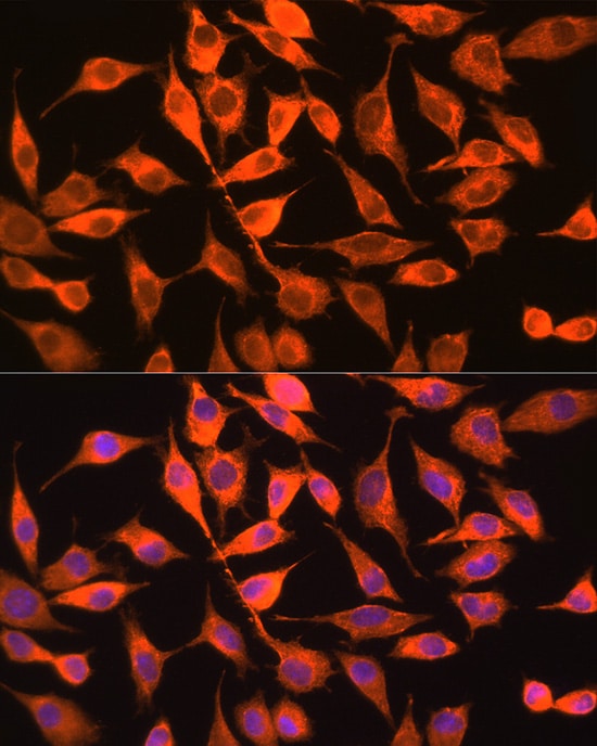 PITPN Antibody - Azide and BSA Free