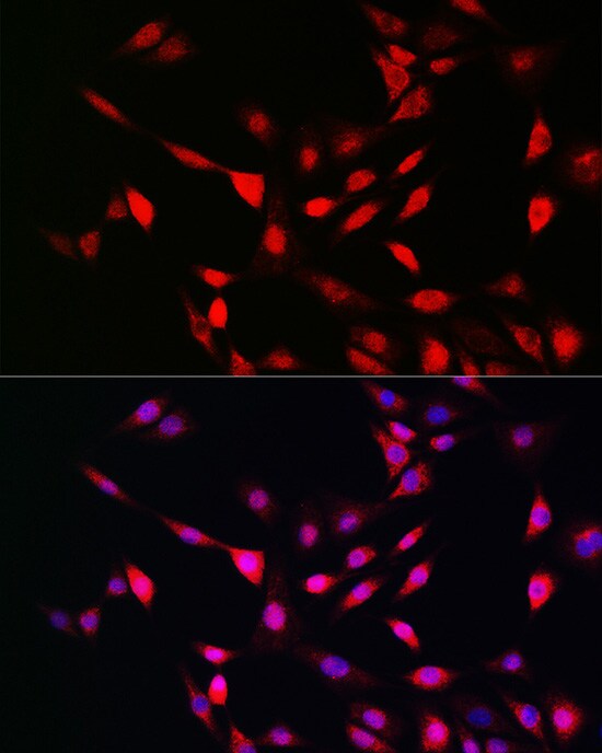 UFM1 Antibody - Azide and BSA Free