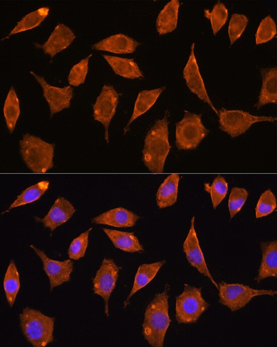 TXNRD2 Antibody - BSA Free