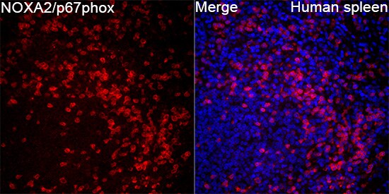 p67phox/NOXA2 Antibody - BSA Free