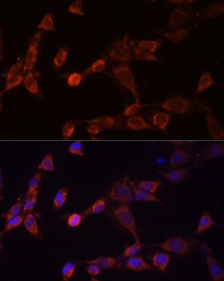 PSMD14 Antibody - Azide and BSA Free