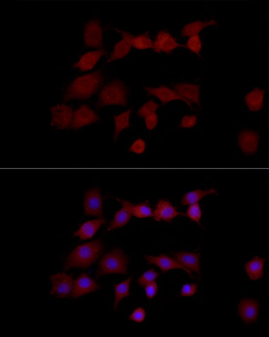NGLY1 Antibody - Azide and BSA Free
