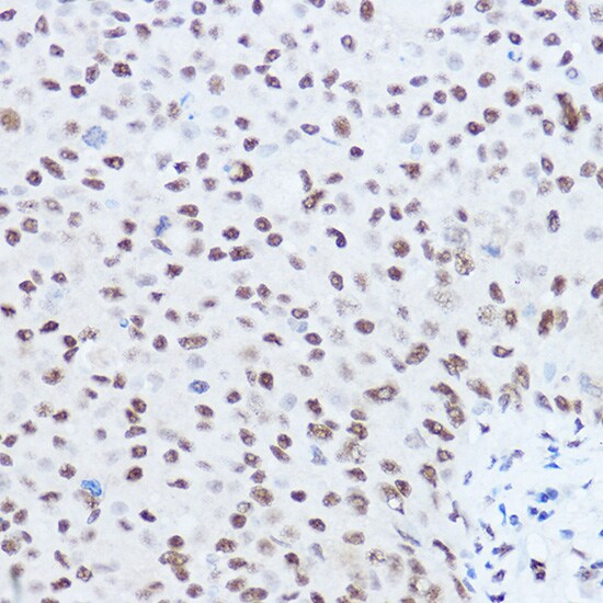 SKIV2L2 Antibody - BSA Free