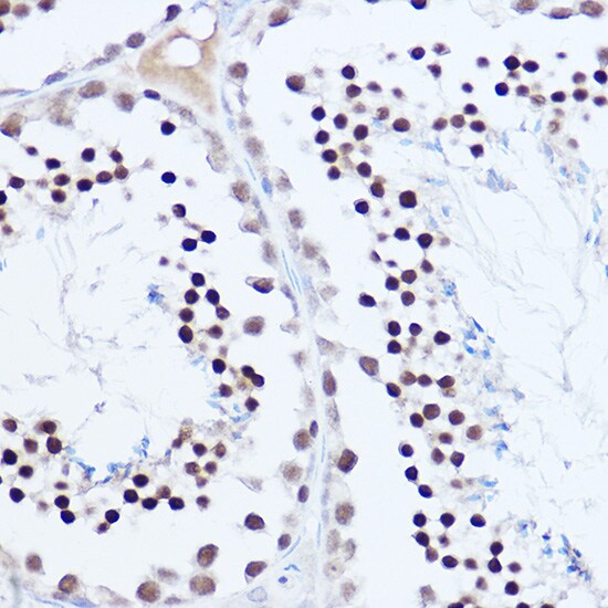 SKIV2L2 Antibody - BSA Free