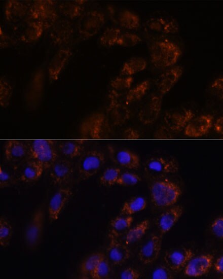 TMED3 Antibody - Azide and BSA Free