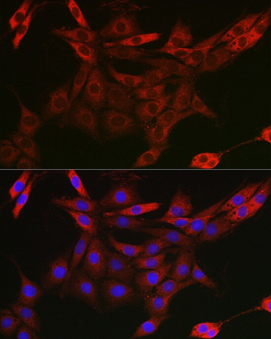 UBQLN4/CIP75 Antibody - Azide and BSA Free